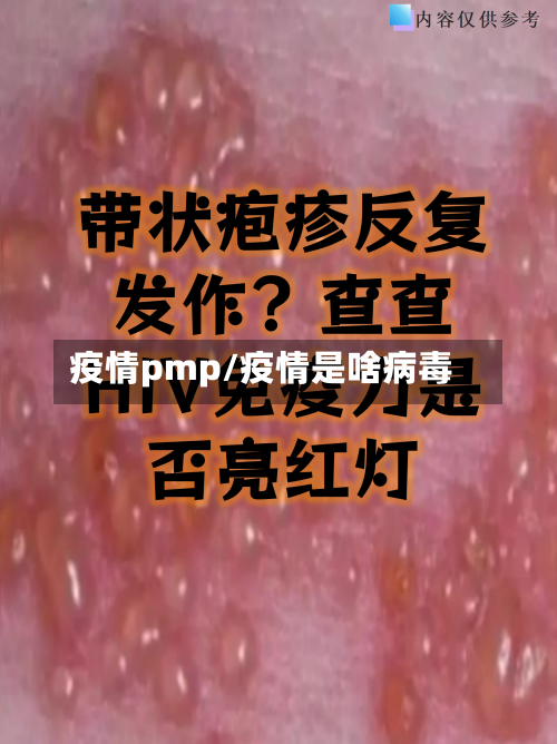 疫情pmp/疫情是啥病毒-第1张图片