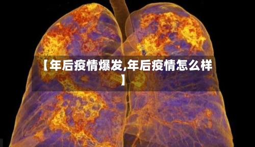 【年后疫情爆发,年后疫情怎么样】-第1张图片